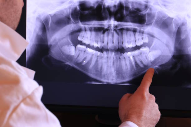 Best Walk-In Emergency Dentist in Littlerock, CA