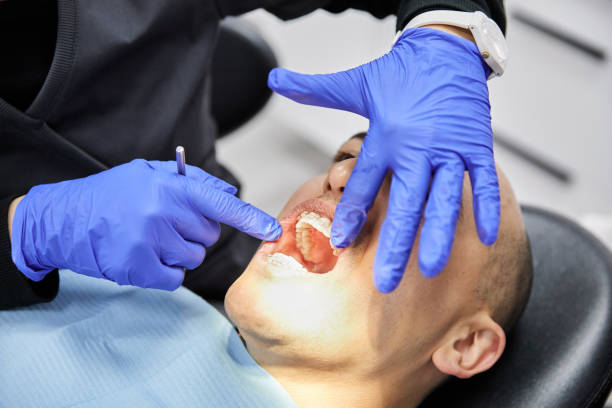 Best Walk-In Emergency Dentist in Littlerock, CA